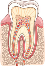 root canal